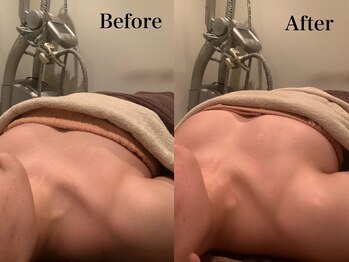 ジェイオー(J.O)/バストアップコルギ/小顔コルギ