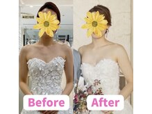 ボディキュア ブライダル美容整体 大阪梅田/【鎖骨復活】デコルテ美人/関西