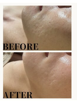 エミルカ 自由が丘店(EMILUCA)/