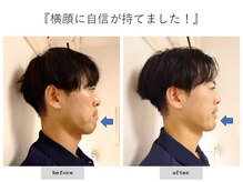 エピファニー(Epiphany)/ここまで変わる！