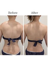 セルノヴァ(Cell Nova)/上半身痩身/痩身ダイエット