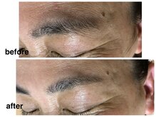 アップル マリー 江別/■糸脱毛（似合わせ眉毛脱毛）