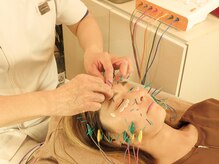 テンジンはり灸院(tenjinはり灸院)/目元は円皮鍼