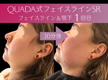 マイスター整体院 天神院の雰囲気（#小顔矯正 #肩甲骨はがし #反り腰 #不眠 #頭痛 #二重アゴ #福岡）