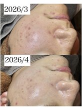 ブラックボックス(BLACK BOX)/20代男性のお客様