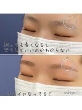 アイル(I'll)/剃ったら青くなる部分をキレイに