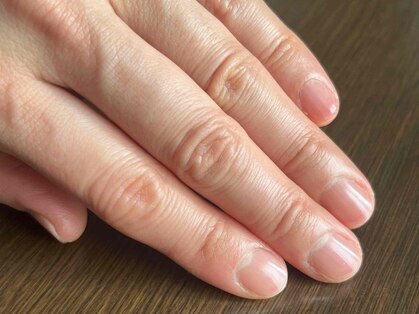 ネイルトリム(nailtrim)の写真