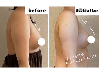 つばききよら/20代のお客様☆３回目でアップ！