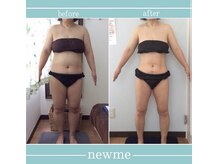 ニュウミー 諏訪本店(newme)/お客様ビフォーアフター