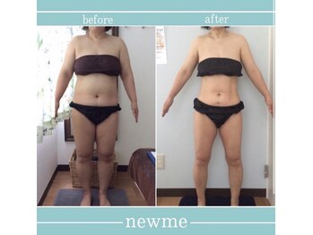ニュウミー 諏訪本店(newme)/お客様ビフォーアフター