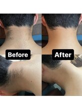 サマラボ 笹塚店(Sama Labo)/意外に見られているうなじや背中