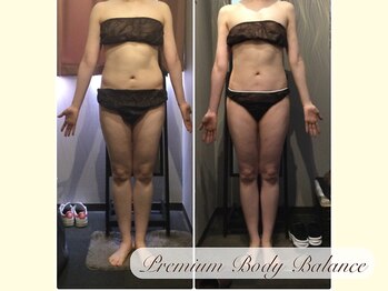 美プレミアム 越谷店/ １６、施術結果