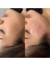 【肌美人御用達人気メニュー】艶肌を目指せるフェイスワックス
