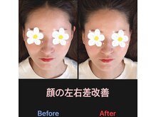 美容矯正サロン レレポノ(LELEPONO)/