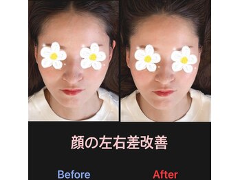 美容矯正サロン レレポノ(LELEPONO)/