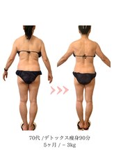 コーラル(Coral)/デトックス痩身（70代施術結果）