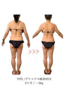 コーラル(Coral)/デトックス痩身(70代施術結果)