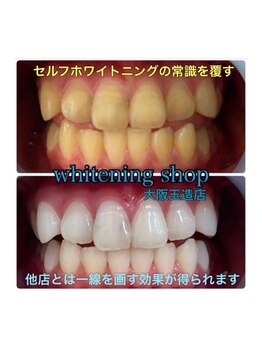 ホワイトニングショップ 八代店/