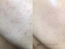 ボタニック 福津店(BoTANiC)