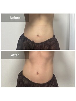 インナーメス(INNER MES)/【痩身】脂肪撃退浮き出る腹筋!