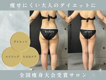 ヴィナーレ(VINARE)