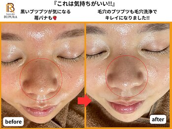 ブプラ 香椎店(BUPURA)/before→after