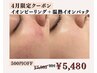 【平日限定】環境変化でニキビが増えた方へ｜1回で変化ありニキビ特化コース