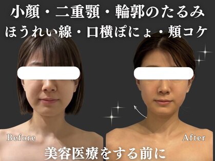リオ(Rio)の写真