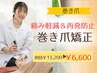 【巻き爪】痛み軽減&再発予防 初回¥13200→¥6600