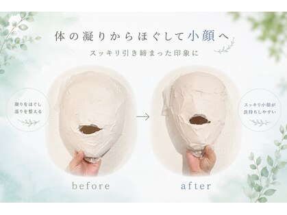 エクシア(ECXIA)の写真