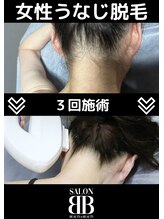 ビービー(BB)/レディースうなじ脱毛