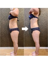 ワンルーム(1ROOM)/キャビゼロ痩身