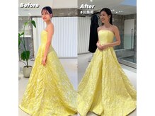 コルミチョン サロン(骨美整 salon)/ブライダル施術　Before・After