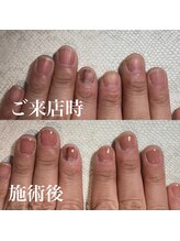 スティラ(Stila)/自爪育成/深爪育成/ネイルケア