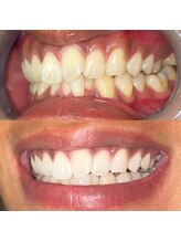 ライトビューティー 池袋店(LightBeauty)/症例写真