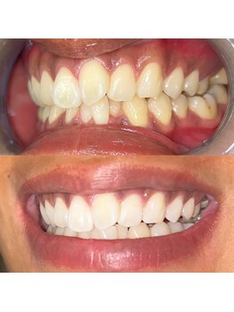 ライトビューティー 池袋店(LightBeauty)/症例写真