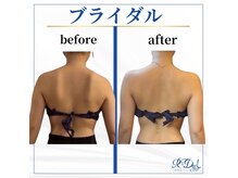 デール(R:DeeL)の雰囲気（脱毛しながら、美肌ケアや小顔ケアを同時に出来るサロン）