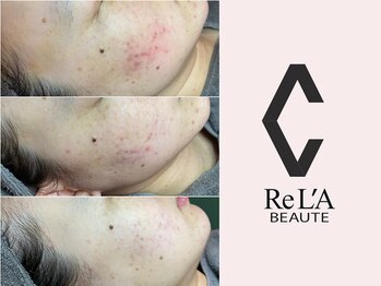 ルシェリア(Le cherien)/