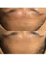 エステサロン マコ(MaCo)/50代・しわ改善/くすみケア