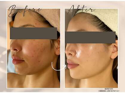 肌イズム つくば店(肌ism)の写真