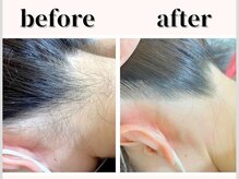 フルーブラン(Frubran)/都度払いで始める女性全身脱