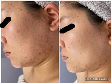 ラヴィアンローズ 津島店(La vie en Rose)/◇ビフォーアフター◇