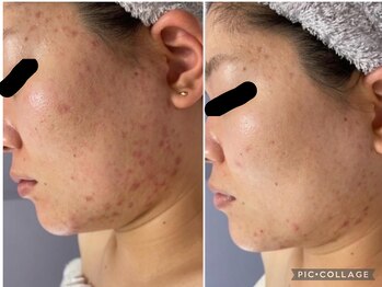 ラヴィアンローズ 津島店(La vie en Rose)/◇ビフォーアフター◇