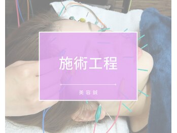 わきさか鍼灸整骨院・鍼灸院 レーヴ(Reve)/