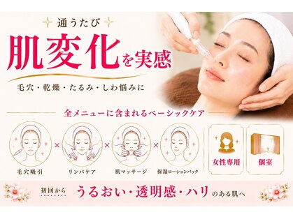 ビューネット(BEAUNet)の写真