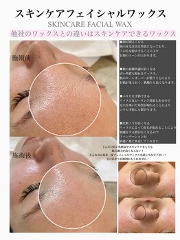 ルーナ(Runa)/産毛脱毛・毛穴詰まりにはWAXXXX