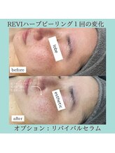 ネイルズビー 別邸(Nail's be)/本気の肌質改善！