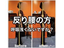カワル整体 上通り院/反り腰は呼吸浅い