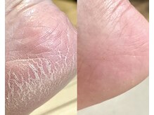 ラヴァンド(Lavande)の雰囲気(これからの季節、角質ケアでぷるぷるかかとに♪)