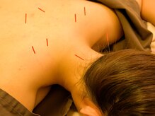 メディカルスパ みなとみらい鍼灸院の雰囲気(肩こりにも♪)